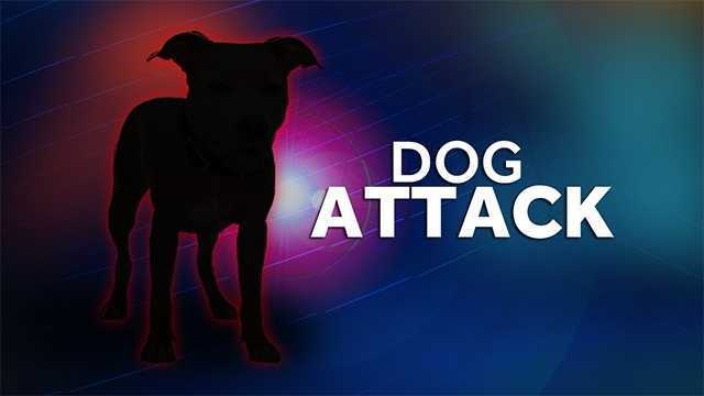 Bacliff man dies after attack by his own dogs, sheriff’s office&nbsp;says